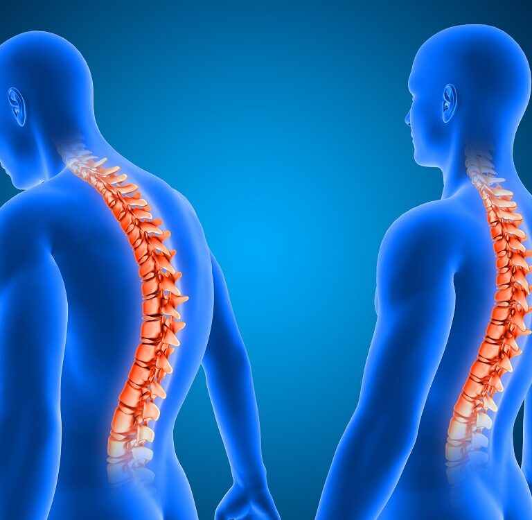 3D render of a medical background showing correct and poor posture with spine highlighted
